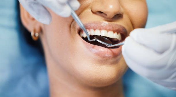 Trusted GA Emergency Dental Service Experts